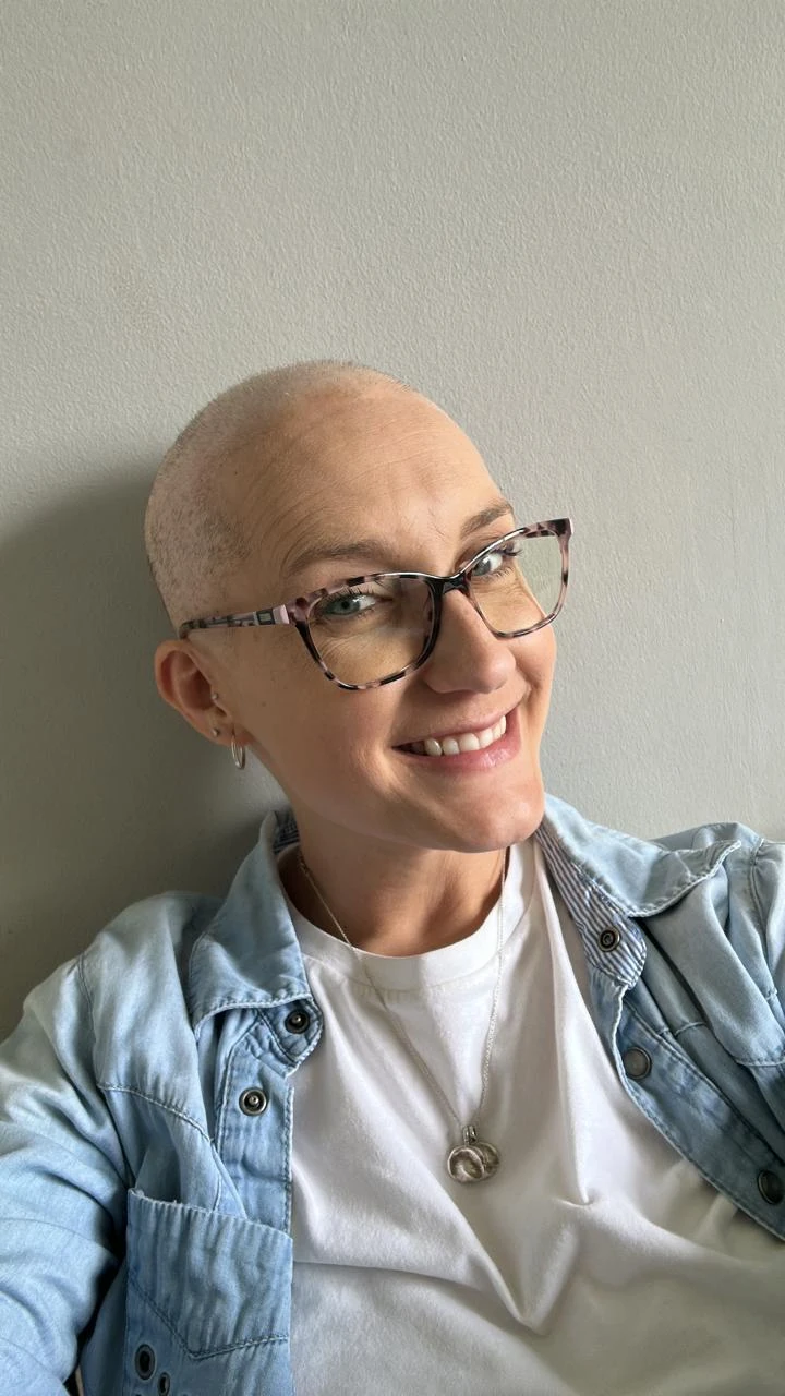 Megan lost all her hair but chose to not hide it under a wig. 