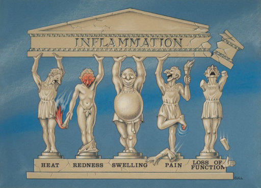 'Inflammation'