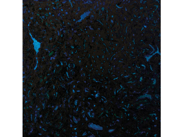 Zenker Brothers, Immersion Zenker Brothers, Immersion