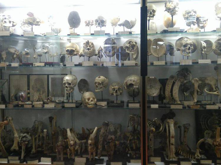 Musée Dupuytren, royaume des pathologies anatomiques