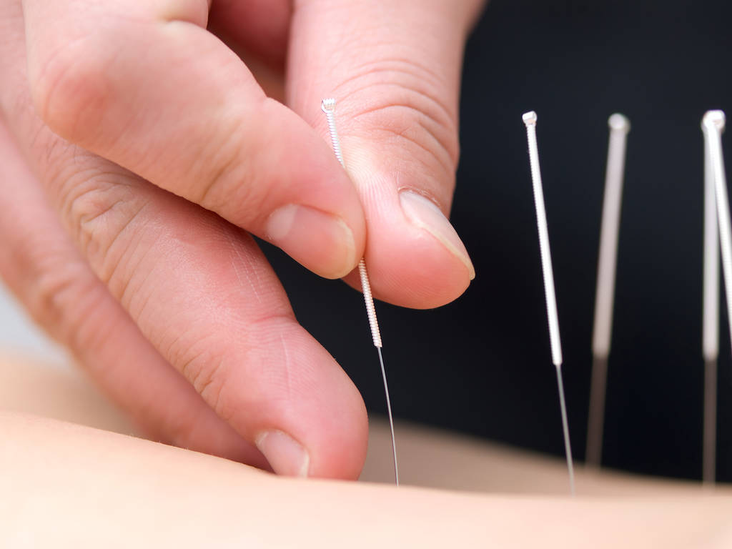 Find an acupuncturist in NYC at an alternative medicine studio