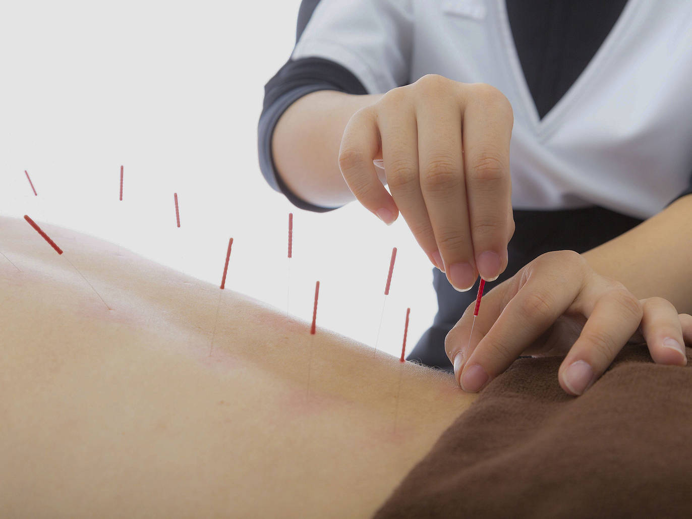 Find an acupuncturist in NYC at an alternative medicine studio