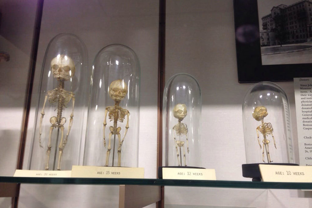 Warren Anatomical Museum Museums in Mission Hill, Boston