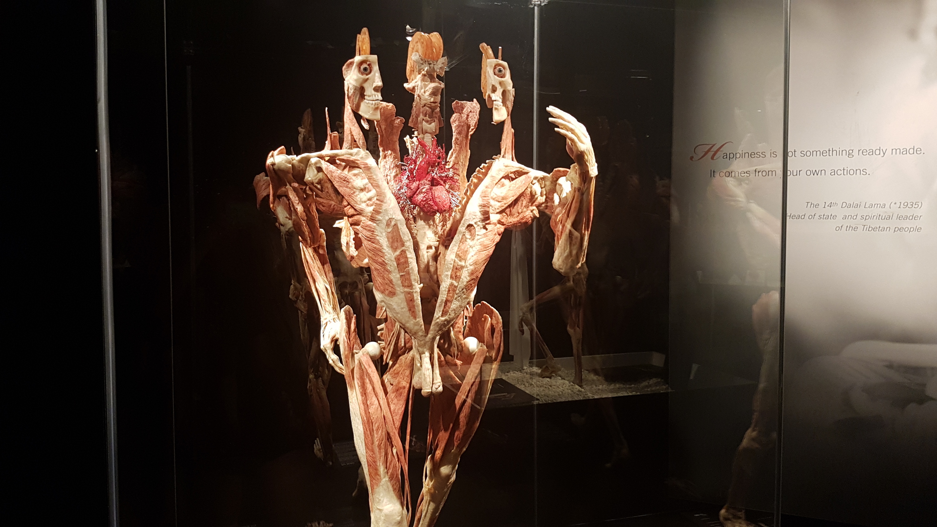 Sydney's second exhibition of real human bodies says they ...