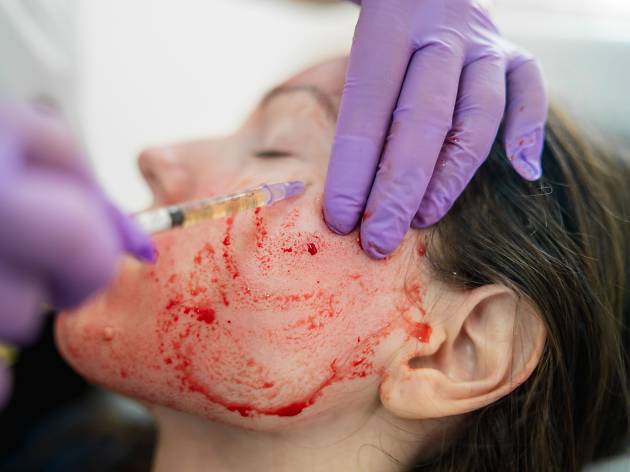 Facial vampiro Facial vampiro