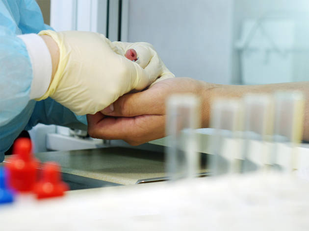 Dónde hacerte la prueba de VIH en la CDMX Dónde hacerte la prueba de VIH en la CDMX