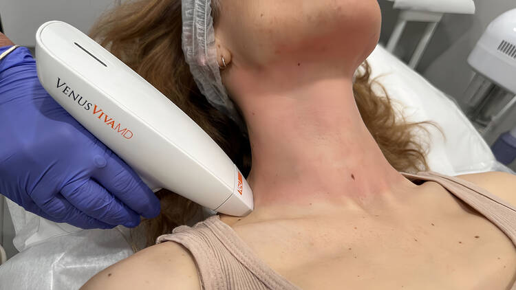 woman laser (BYou Laser)
