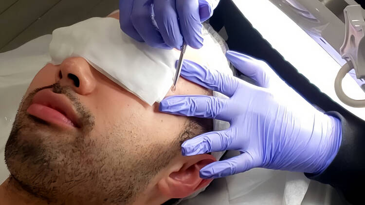 Man Facial (BYou Laser)