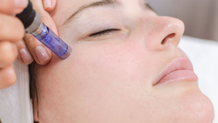 woman micro (BYou Laser)
