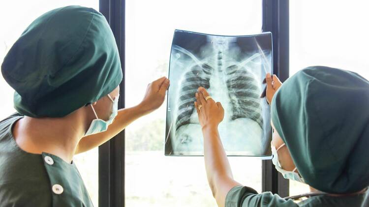 Tuberculosis is on the rise
