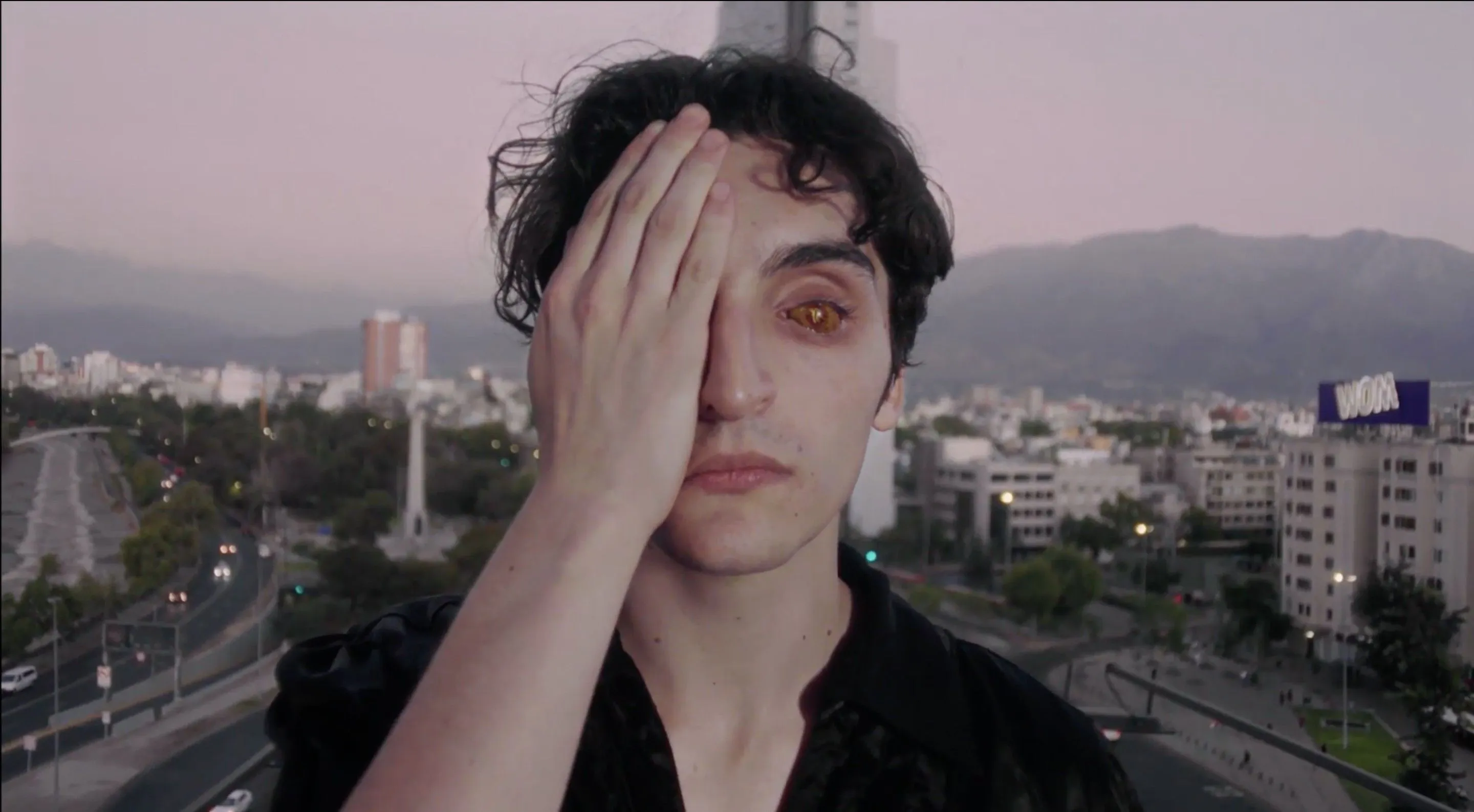 Trauma ocular, Voluspa Jarpa