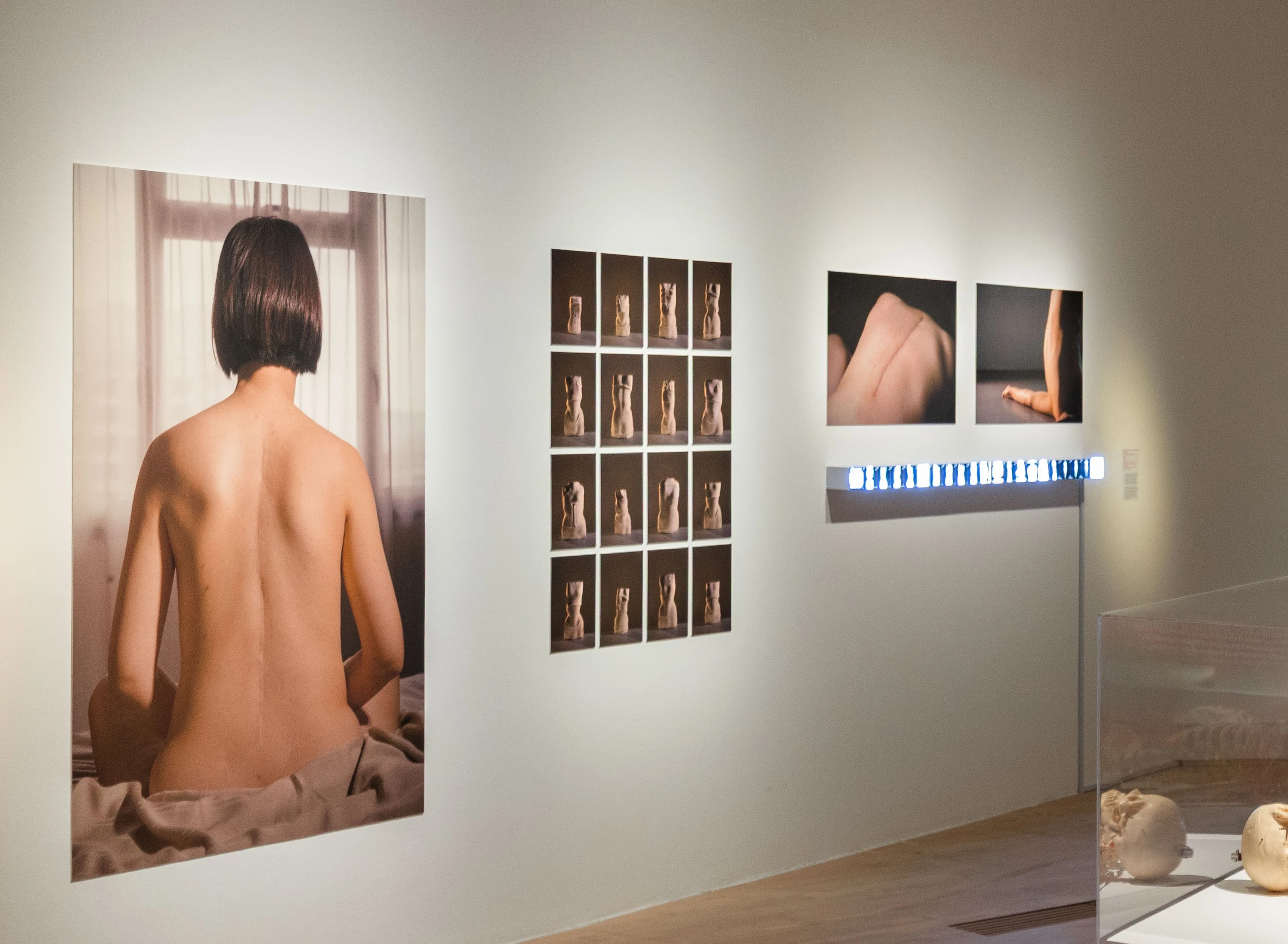 'rules for photographing a scoliotic patient' by Woong Soak Teng 