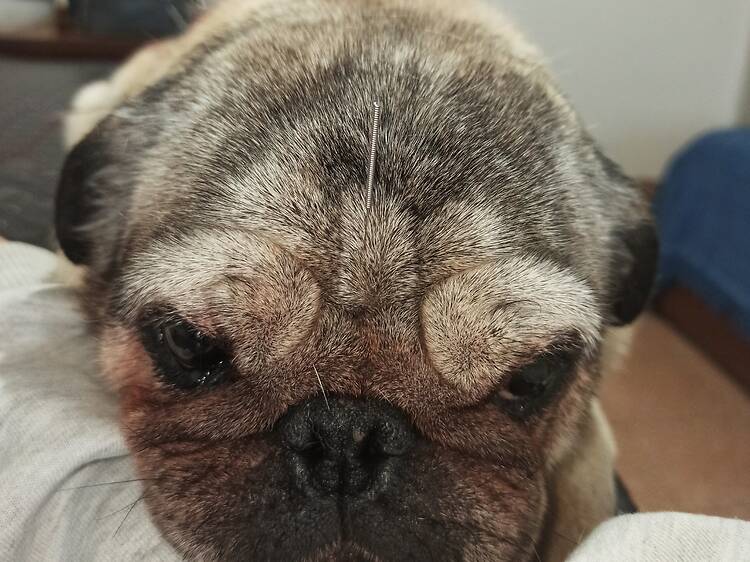 Acupuncture